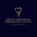 DENTAL IMPLANTS AND PERIODONTAL HEALTH