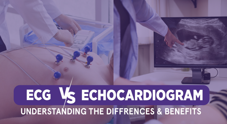 ECG vs. Echocardiogram - Understanding Differences & Benefits