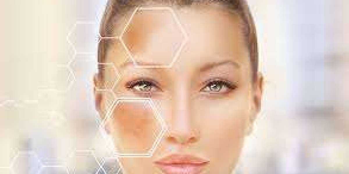 Hyperpigmentation Treatment in Dubai: Unveiling Radiant Skin