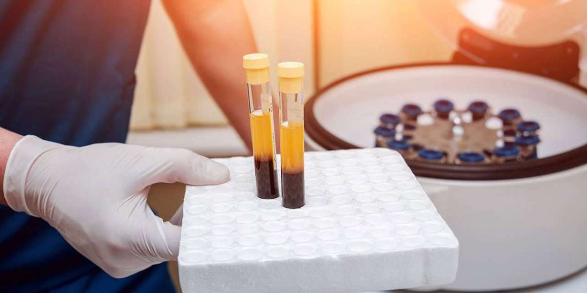 Platelet Rich Plasma Is Estimated To Witness High Growth Owing To Rising Application in Cosmetic Surgery