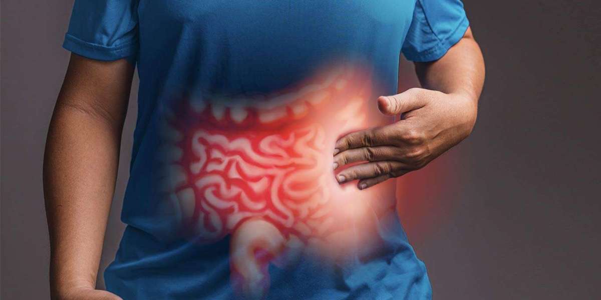 Inflammatory Bowel Disease Treatment Market is Expected to Witness Significant Growth